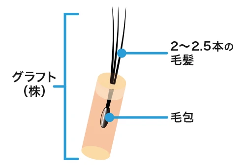 1,000株=毛髪1,000本ではない