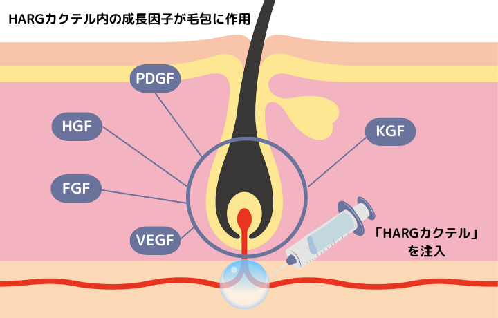 HARGカクテルとは