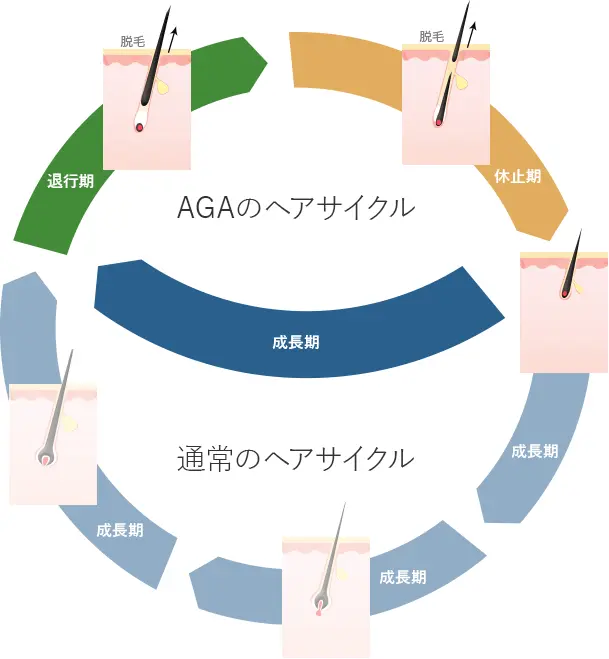 毛周期とは