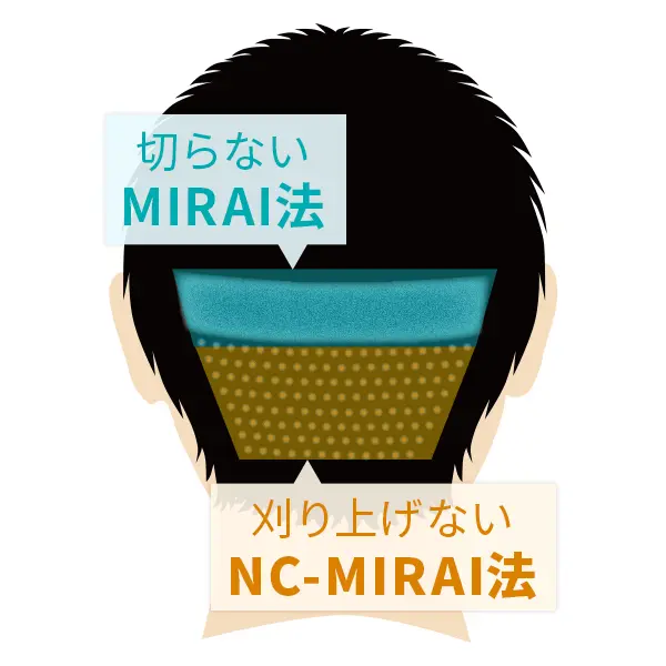 2つの術式の良いところどり『United MIRAI法』