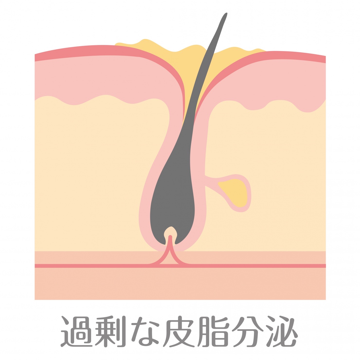 石鹸で洗髪したほうが薄毛改善効果がある？