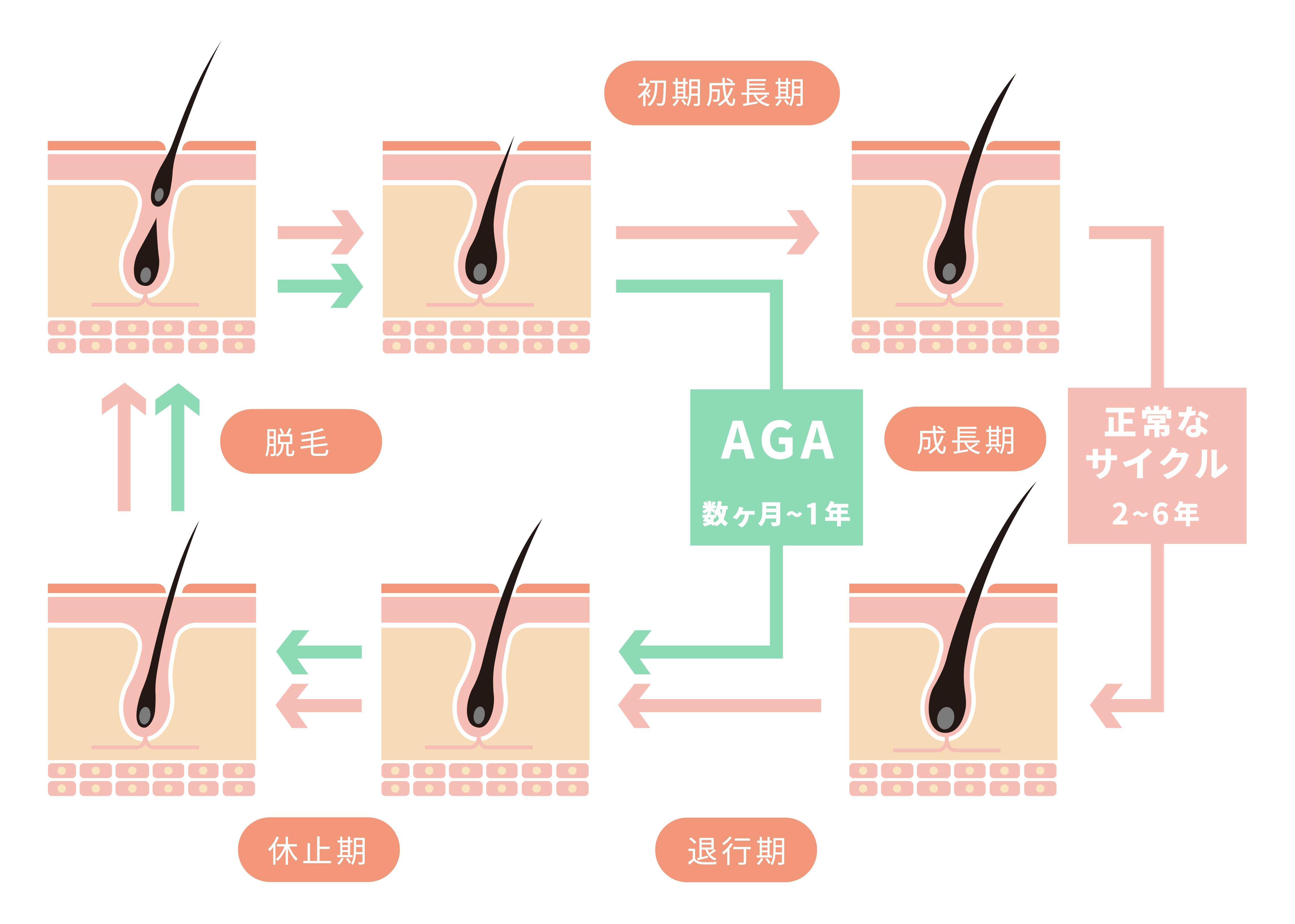 HARG治療のメカニズム