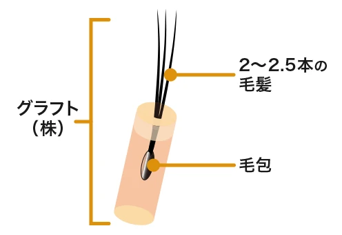 グラフト（株）数
