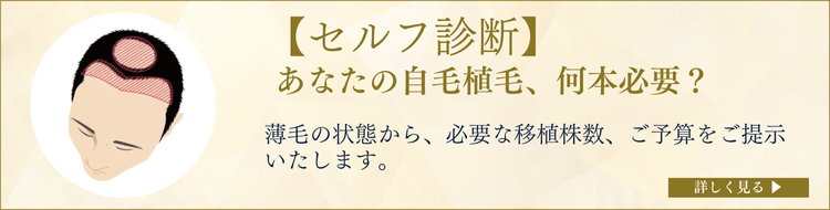 【セルフ診断】あなたの自毛植毛、何本必要？